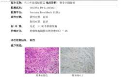 时隔三年，爸爸不幸也患上肺腺癌，Kras G12C突变，STK11突变，TP53突变，求助
