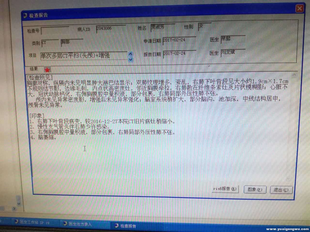 2017年2月24日CT.jpg