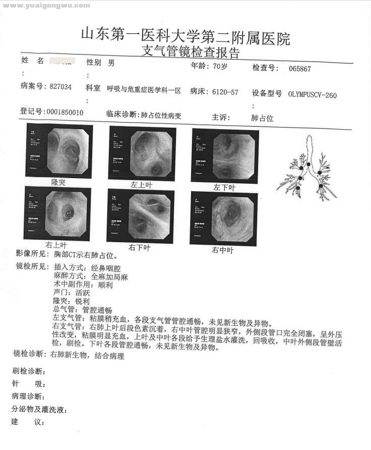 支气管镜检查.png