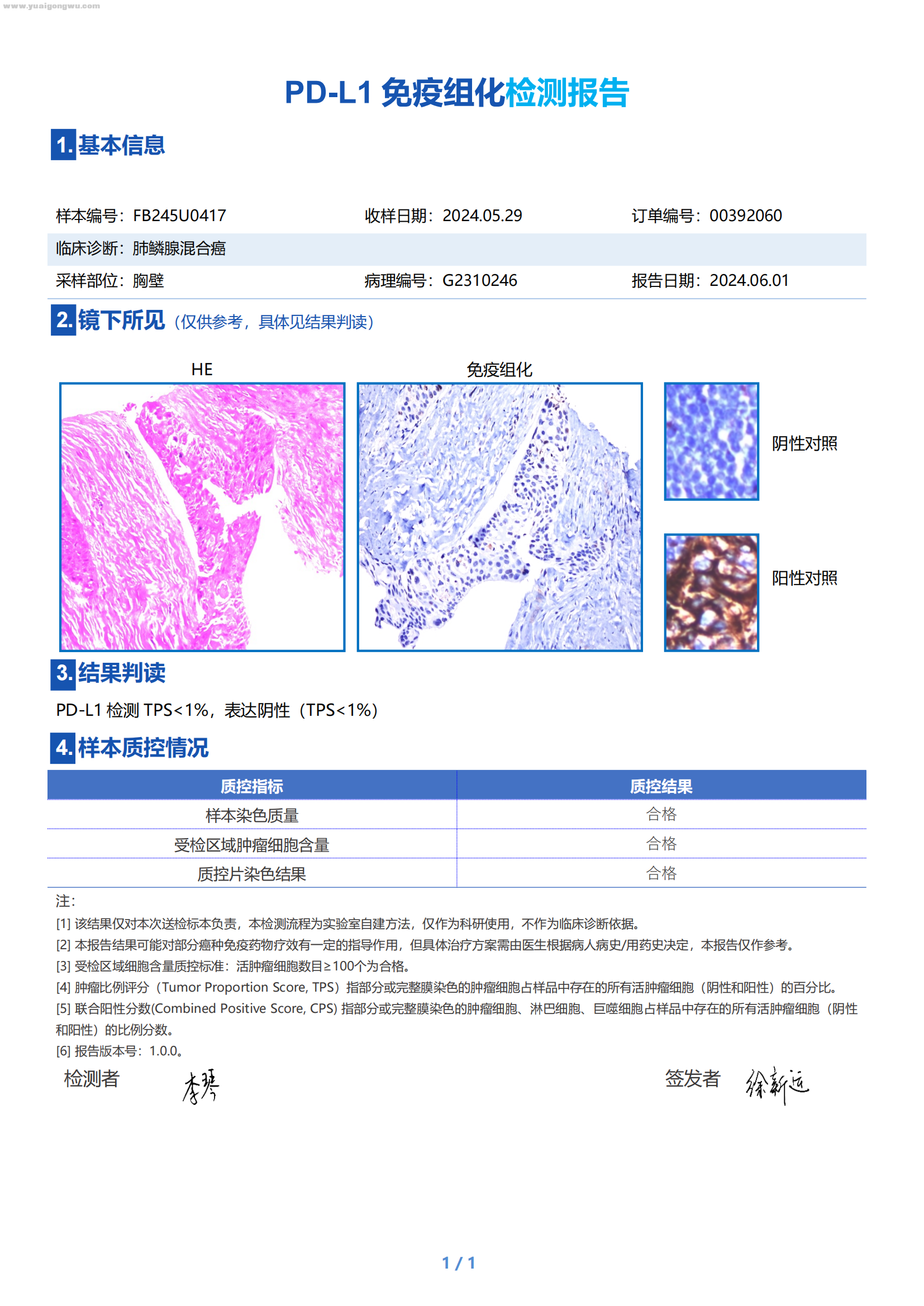 2024.06.01-陈丽娅-00392060-FB245U0417-D-免疫组化检测报告(1)_00.png